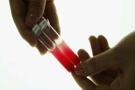 Анализ крови на гормоны при планировании беременности