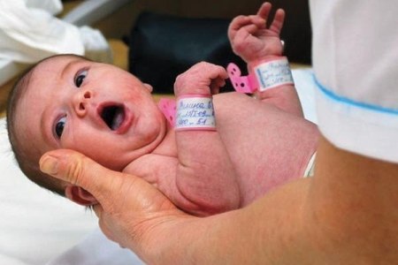 Новорожденный: последствия асфиксии