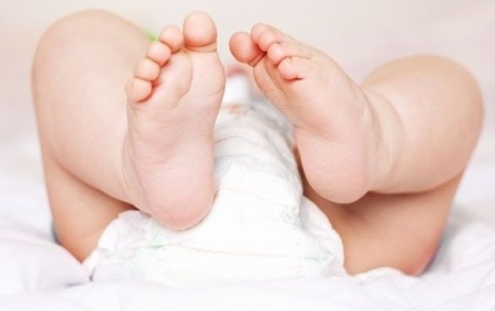 Ребенок: дисплазия тазобедренного сустава у новорожденного