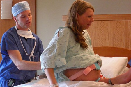 Анестезиолог устанавливает беременной катетер эпидуральной анестезии перед родами.