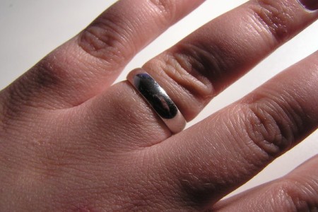 Обручальное кольцо на отекшей руке: часто по тому, как тяжело становится снимать кольца, бесформенные замечают у себя отеки.