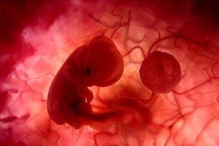 Плод в утробе: полное предлежание плаценты может вызвать гипоксию у ребенка.