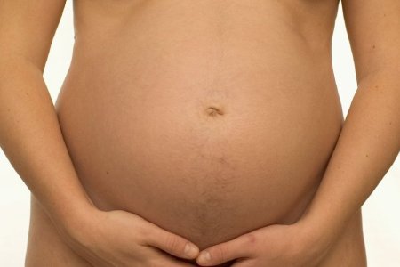 Беременная: узкий таз