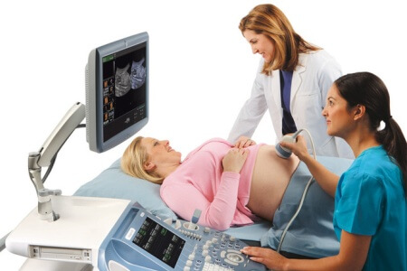 Анализ Доплера при беременности - Рождение ребенка