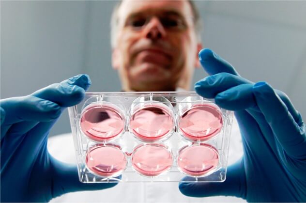 Эмбрионы ЭКО: использование донорской яйцеклетки