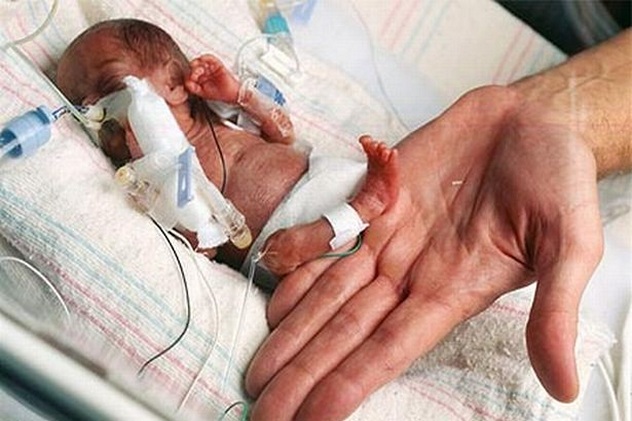 рекорды беременности и родов, самый маленький новорожденный