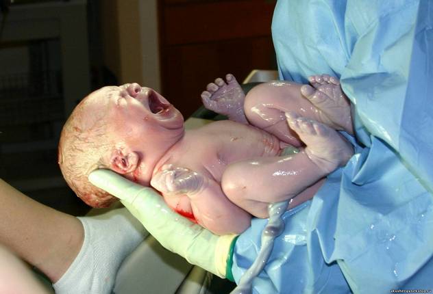 акушерка держит младенца после родов