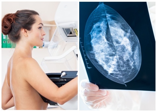 Маммография: диагностика причин, по которым нет овуляции