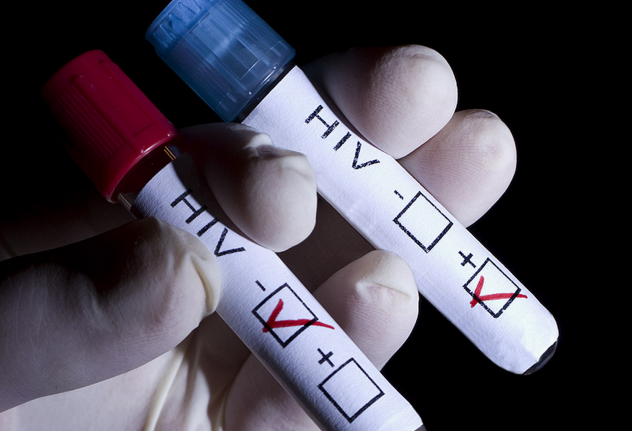 анализ крови на ВИЧ