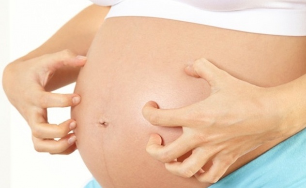 кожный зуд во время беременности