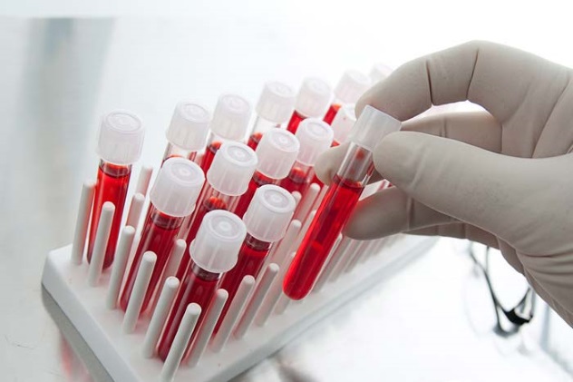 анализ крови на уровень антимюллерова гормона