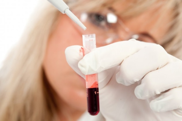 качественный и количественный анализ крови на хгч