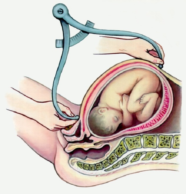 измерение живота у беременной