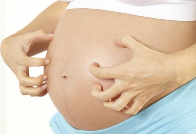 зуд кожи живота на поздних сроках беременности