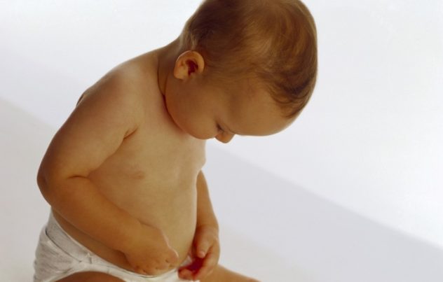 Как определить пупочную грыжу симптомы у ребенка в 2-4 года и детей в 5-7 лет