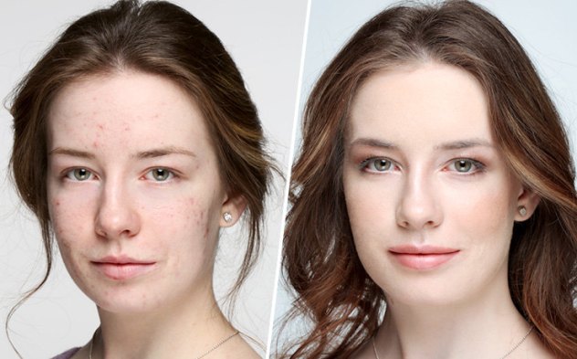 Отсутствие корректора - частая ошибка в макияже