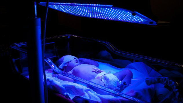 фототерапия при гемолитической болезни новорожденных