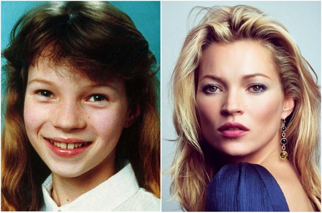 знаменитости, которые в детстве комплексовали из-за своей внешности: Кейт Мосс