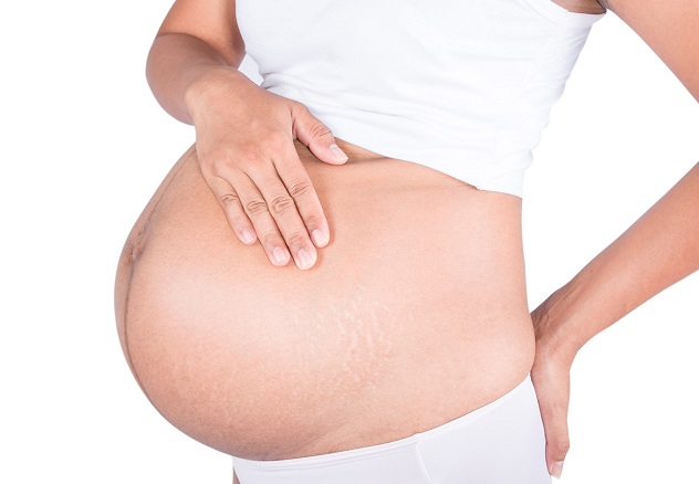 бепантен при беременности применяют для профилактики растяжек