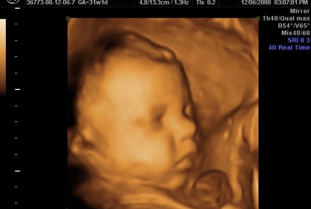 Как лежит ребенок на 30 неделе беременности в животе фото